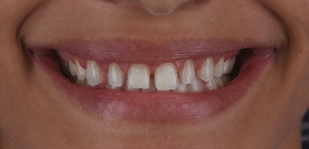 Aspen Dental Care - Dr Pramod Kumar